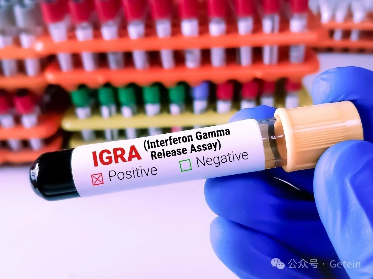 Solución integral y precisa de pruebas TB-IGRA